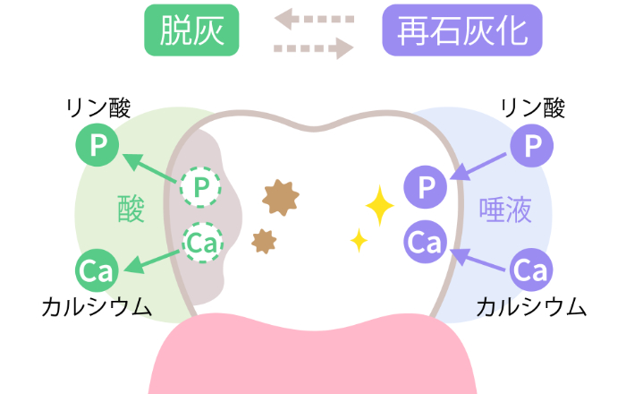 ホワイトニングの後戻りの原因：再石灰化