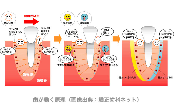 矯正中の気になる痛みの原因：歯の移動による圧力