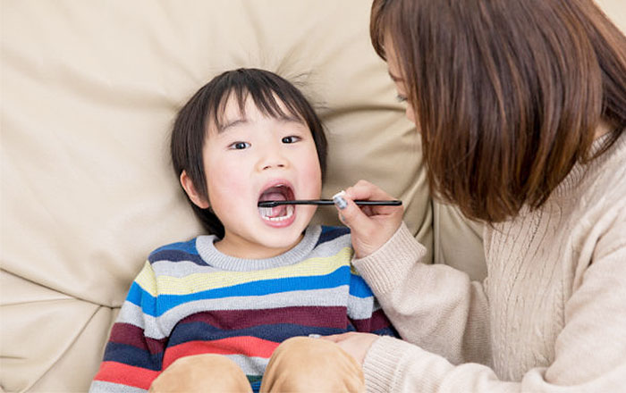 シーラントの注意点：日頃の歯磨きと仕上げ磨きは怠らない