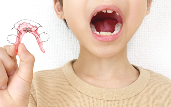 矯正治療中のお子さんのお口の状態を把握する