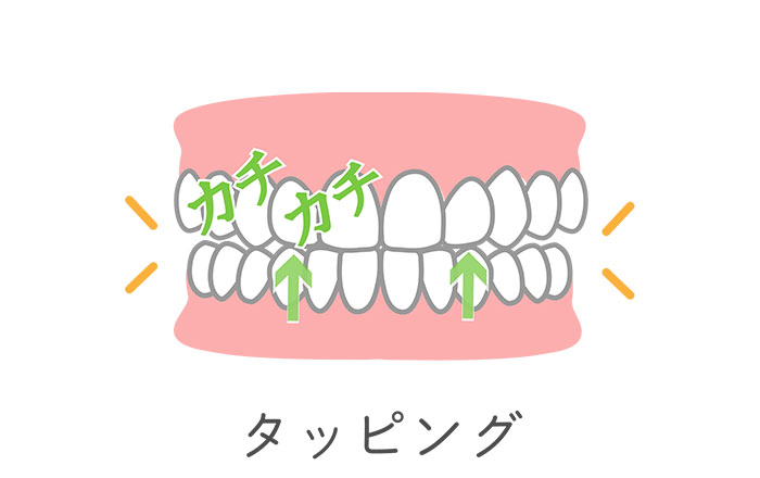 タッピング