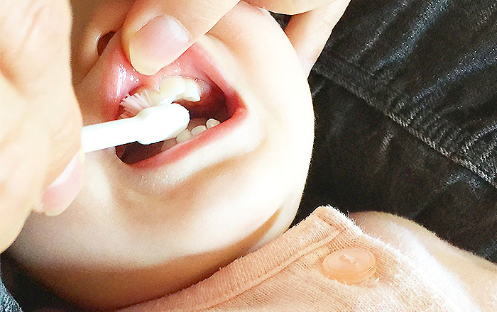 乳歯の磨き方のコツ：動かし方は小刻みに1本ずつ