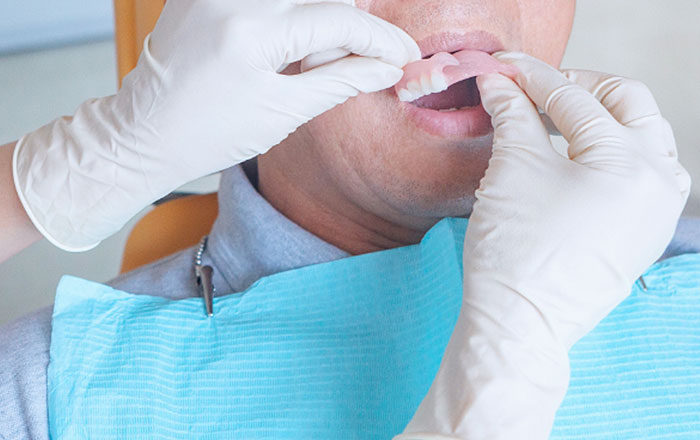 自分に合った入れ歯を選ぶ5つのポイント：⑤ 生活スタイルに合っているか確認する