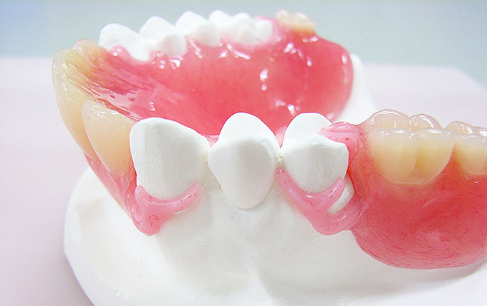 自分にぴったりの入れ歯を使用するために