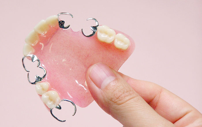 そもそも入れ歯とは