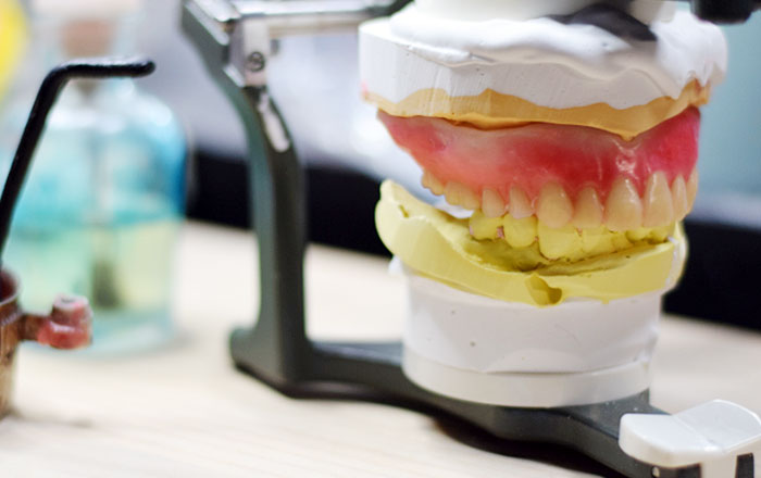 自分に合った入れ歯を選ぶ5つのポイント：② 顎の骨の状態を把握する