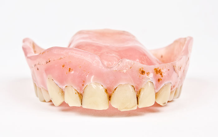 入れ歯にトラブルが起きる5つの原因:③汚れが蓄積している