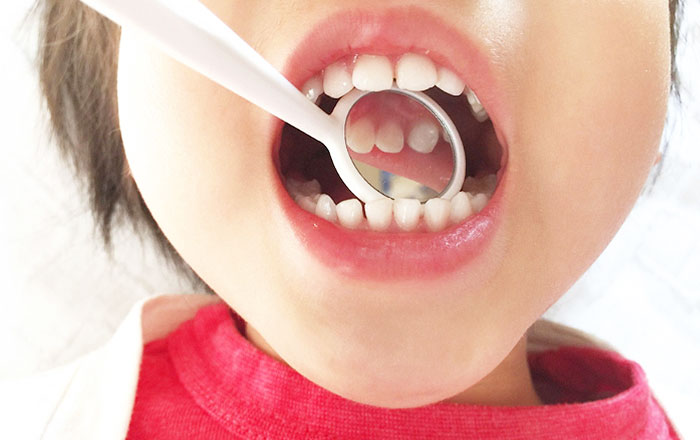 舌・唇・頬の筋肉バランスが歯並びを支えている