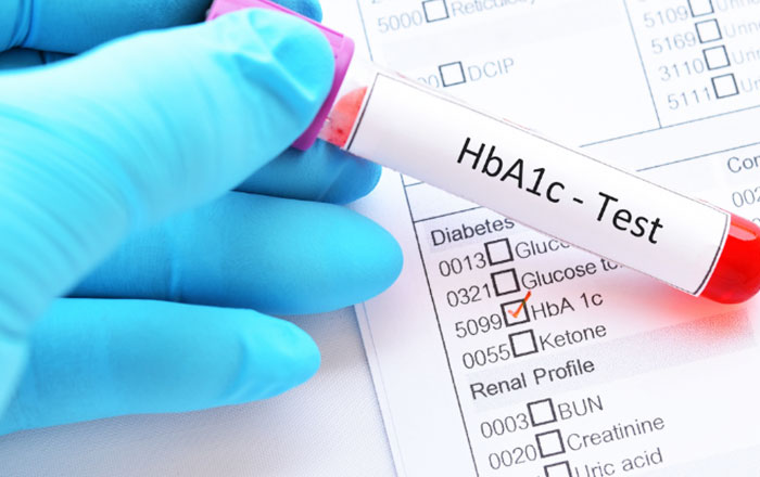 歯周治療でHbA1cは約0.5%改善する